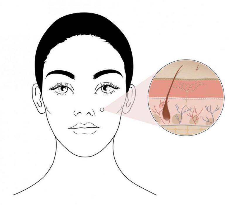 image d'illustration